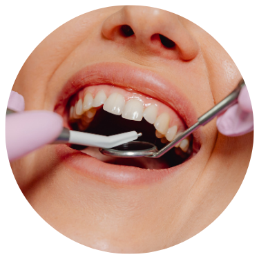 Dental Tools